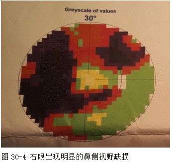 ZY016_154_5.gif